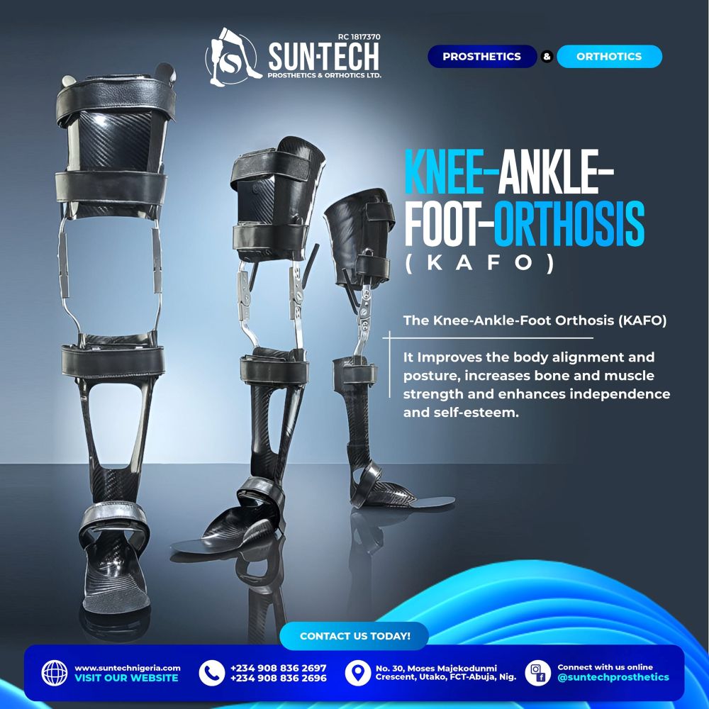 Prosthetics in Abuja 3 SunTech Prosthetics and Orthotics Ltd