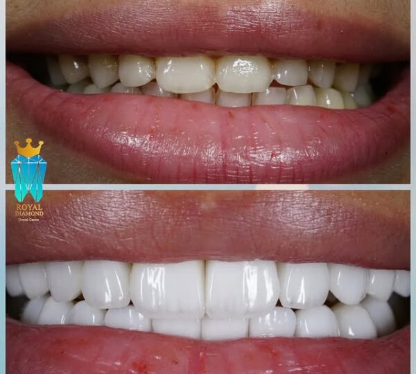 Royal Diamond Clinic Abuja 2 1