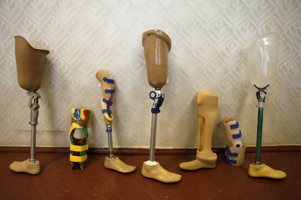 prosthetic leg in Nigeria